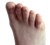 Corns