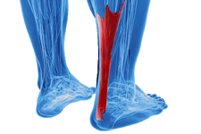 achilles-tendon